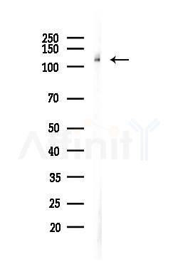 E-cadherin Antibody - Western blot analysis of lysates from LoVo cells(heat-shock, 45min treatment), using E-cadherin Antibody at 1/1000 dilution.