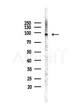EEF2 Antibody - Western blot analysis of lysates from A375 cells(heat-shock, 45min treatment), using EEF2 Antibody at 1/1000 dilution.