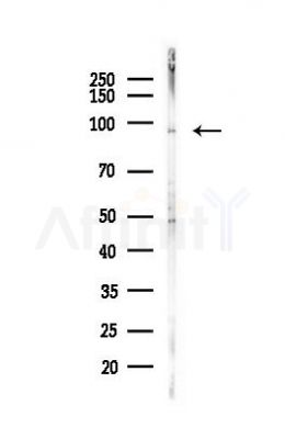 EEF2 Antibody - Western blot analysis of lysates from LoVo cells(heat-shock, 45min treatment), using EEF2 Antibody at 1/1000 dilution.