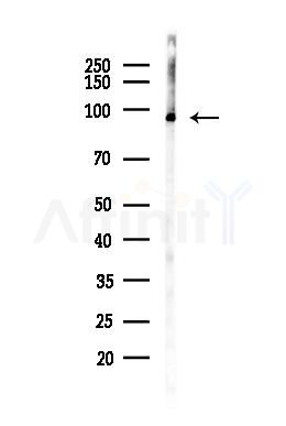 EEF2 Antibody - Western blot analysis of lysates from LoVo cells(heat-shock, 45min treatment), using EEF2 Antibody at 1/1000 dilution.