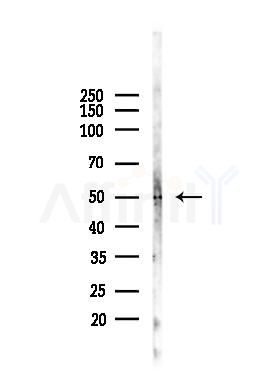 Coagulation Factor III Antibody - Western blot analysis of lysates from A375 cells(heat-shock, 45min treatment), using Coagulation Factor III Antibody at 1/1000 dilution.