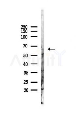 PKM2 Antibody - Western blot analysis of lysates from A375 cells(heat-shock, 45min treatment), using PKM2 Antibody at 1/1000 dilution.