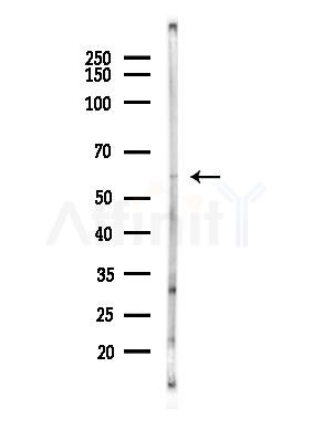 PKM2 Antibody - Western blot analysis of lysates from LoVo cells(heat-shock, 45min treatment), using PKM2 Antibody at 1/1000 dilution.