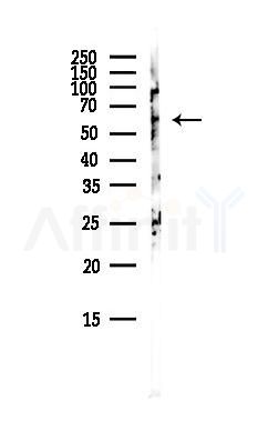 PKM2 Antibody - Western blot analysis of lysates from Rat brain, using PKM2 Antibody at 1/1000 dilution.