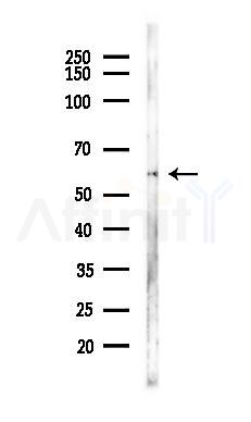 PKM2 Antibody - Western blot analysis of lysates from A375 cells(heat-shock, 45min treatment), using PKM2 Antibody at 1/1000 dilution.