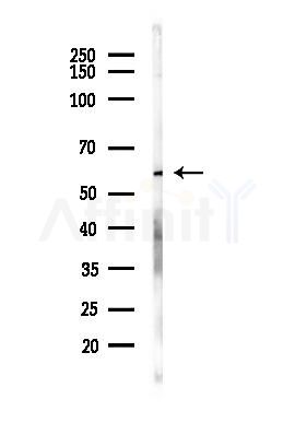 PKM2 Antibody - Western blot analysis of lysates from LoVo cells(heat-shock, 45min treatment), using PKM2 Antibody at 1/1000 dilution.