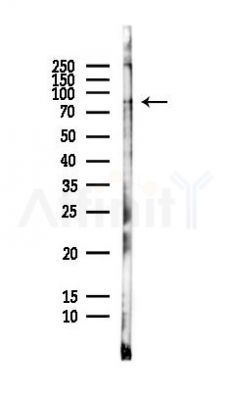 IFNGR1 Antibody - Western blot analysis of lysates from HepG2 cells(LPS,4h treatment), using IFNGR1 Antibody at 1/1000 dilution.