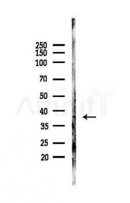 JunB Antibody - Western blot analysis of lysates from A375 cells(heat-shock, 45min treatment), using JunB Antibody at 1/1000 dilution.