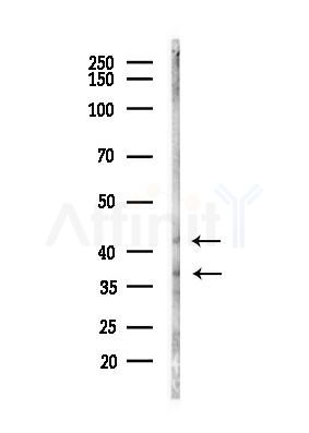 PKA alpha/beta/gamma CAT Antibody - Western blot analysis of lysates from Mouse brain, using PKA alpha/beta/gamma CAT Antibody at 1/1000 dilution.