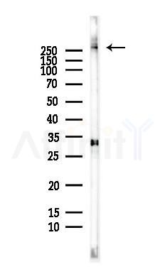 Filamin A Antibody - Western blot analysis of lysates from HepG2 cells(LPS,4h treatment), using Filamin A Antibody at 1/1000 dilution.