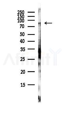 FGFR4 Antibody - Western blot analysis of lysates from RAW264.