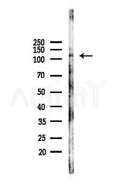 CBL Antibody - Western blot analysis of lysates from A375 cells(heat-shock, 45min treatment), using CBL Antibody at 1/1000 dilution.