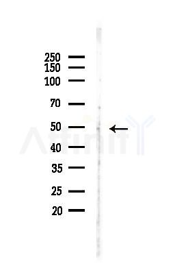GATA2 Antibody - Western blot analysis of lysates from A375 cells(heat-shock, 45min treatment), using GATA2 Antibody at 1/1000 dilution.