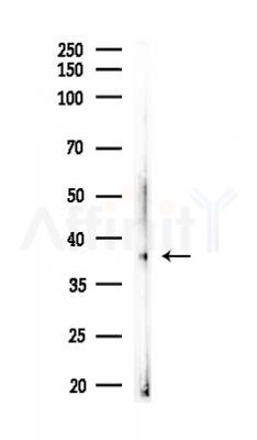 IKB alpha Antibody - Western blot analysis of lysates from HUVEC cells(LPS, 4h treatment), using IKB alpha Antibody at 1/1000 dilution.