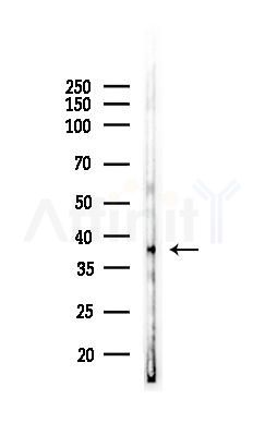 IKB alpha Antibody - Western blot analysis of lysates from COLO205 cells(LPS, 4h treatment), using IKB alpha Antibody at 1/1000 dilution.