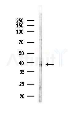 CrkL Antibody - Western blot analysis of lysates from COLO205 cells(LPS, 4h treatment), using CrkL Antibody at 1/1000 dilution.