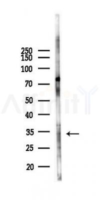 TNNI3 Antibody - Western blot analysis of lysates from Mouse liver, using TNNI3 Antibody at 1/1000 dilution.