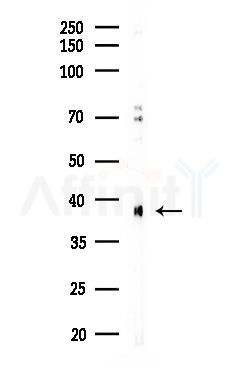CDK7 Antibody - Western blot analysis of lysates from HUVEC cells(LPS, 4h treatment), using CDK7 Antibody at 1/1000 dilution.