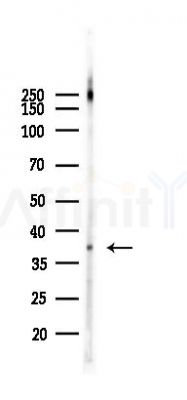 MKK6 Antibody - Western blot analysis of lysates from HepG2 cells(heat-shock,45min treatment), using MKK6 Antibody at 1/1000 dilution.