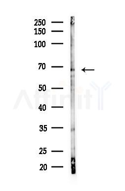 PLK1 Antibody - Western blot analysis of lysates from HUVEC cells(LPS, 4h treatment), using PLK1 Antibody at 1/1000 dilution.