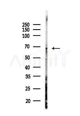 PLK1 Antibody - Western blot analysis of lysates from COLO205 cells(LPS, 4h treatment), using PLK1 Antibody at 1/1000 dilution.