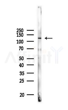 ATP citrate lyase Antibody - Western blot analysis of lysates from PC12 cells, using ATP citrate lyase Antibody at 1/1000 dilution.