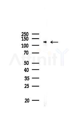 p130 Cas Antibody - Western blot analysis of lysates from PC12 cells, using p130 Cas Antibody at 1/1000 dilution.