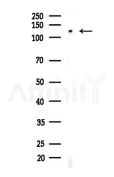p130 Cas Antibody - Western blot analysis of lysates from HUVEC cells(LPS, 4h treatment), using p130 Cas Antibody at 1/1000 dilution.