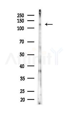 p130 Cas Antibody - Western blot analysis of lysates from HUVEC cells(LPS, 4h treatment), using p130 Cas Antibody at 1/1000 dilution.