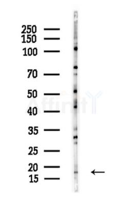 Histone H3 Antibody - Western blot analysis of lysates from A375 cells(heat-shock,45min treatment), using Histone H3 Antibody at 1/1000 dilution.