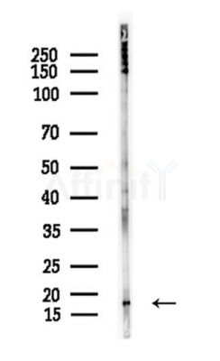 Histone H3 Antibody - Western blot analysis of lysates from A375 cells(heat-shock,45min treatment), using Histone H3 Antibody at 1/1000 dilution.