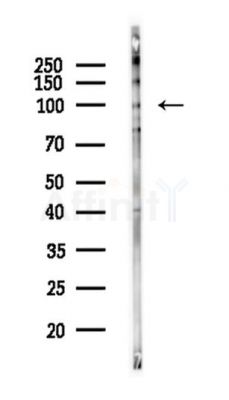 PSD95 Antibody - Western blot analysis of lysates from PC12 cells, using PSD95 Antibody at 1/1000 dilution.