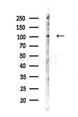 PSD95 Antibody - Western blot analysis of lysates from LoVo cells(heat-shock,45min treatment), using PSD95 Antibody at 1/1000 dilution.
