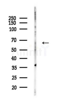 FOXO4 Antibody - Western blot analysis of lysates from A375 cells(heat-shock,45min treatment), using FOXO4 Antibody at 1/1000 dilution.