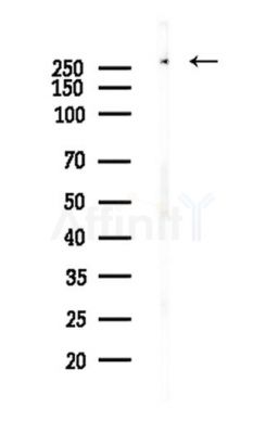 eIF4G1 Antibody - Western blot analysis of lysates from A375 cells(heat-shock,45min treatment), using eIF4G1 Antibody at 1/1000 dilution.