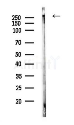 eIF4G1 Antibody - Western blot analysis of lysates from PC12 cells, using eIF4G1 Antibody at 1/1000 dilution.