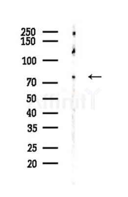 BTK Antibody - Western blot analysis of lysates from LoVo cells(heat-shock,45min treatment), using BTK Antibody at 1/1000 dilution.