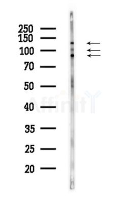 FOXM1 Antibody - Western blot analysis of lysates from A375 cells(heat-shock,45min treatment), using FOXM1 Antibody at 1/1000 dilution.