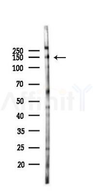 NMDAR2A Antibody - Western blot analysis of lysates from HepG2 cells(heat-shock,45min treatment), using NMDAR2A Antibody at 1/1000 dilution.