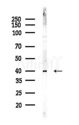 TDP43 Antibody - Western blot analysis of lysates from A375 cells(heat-shock,45min treatment), using TDP43 Antibody at 1/1000 dilution.