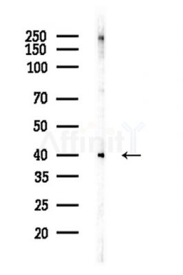 TDP43 Antibody - Western blot analysis of lysates from LoVo cells(heat-shock,45min treatment), using TDP43 Antibody at 1/1000 dilution.