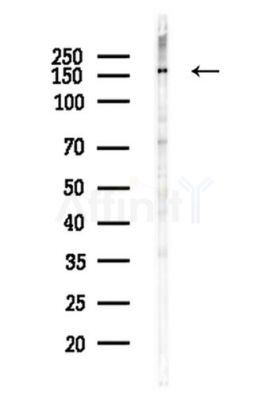 NMDAR2B Antibody - Western blot analysis of lysates from A375 cells(heat-shock,45min treatment), using NMDAR2B Antibody at 1/1000 dilution.