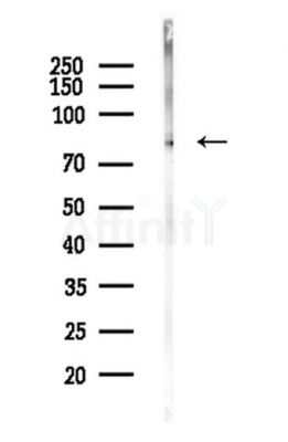 GIT2 Antibody - Western blot analysis of lysates from A375 cells(heat-shock,45min treatment), using GIT2 Antibody at 1/1000 dilution.