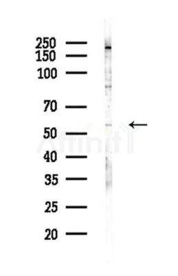 IRF3 Antibody - Western blot analysis of lysates from LoVo cells(heat-shock,45min treatment), using IRF3 Antibody at 1/1000 dilution.
