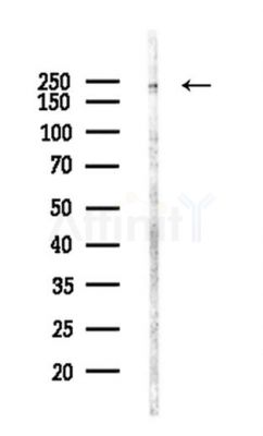 NuMA Antibody - Western blot analysis of lysates from LoVo cells(heat-shock,45min treatment), using NuMA Antibody at 1/1000 dilution.