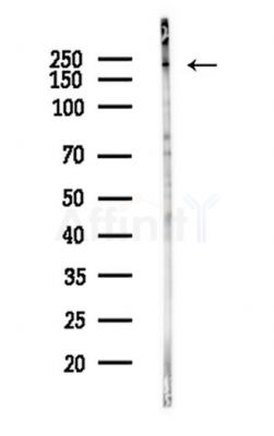 NuMA Antibody - Western blot analysis of lysates from A375 cells(heat-shock,45min treatment), using NuMA Antibody at 1/1000 dilution.