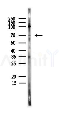 SF1 Antibody - Western blot analysis of lysates from PC12 cells(heat-shock,45min treatment), using SF1 Antibody at 1/1000 dilution.