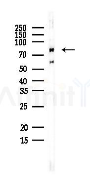 Zyxin Antibody - Western blot analysis of lysates from EC304 cells, using Zyxin Antibody at 1/1000 dilution.
