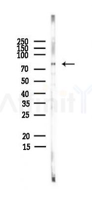 Zyxin Antibody - Western blot analysis of lysates from PC12 cells(heat-shock,45min treatment), using Zyxin Antibody at 1/1000 dilution.