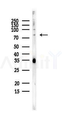 Zyxin Antibody - Western blot analysis of lysates from EC304 cells, using Zyxin Antibody at 1/1000 dilution.